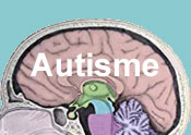 hersenen en autisme